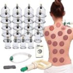 Cupping Set - Image 3